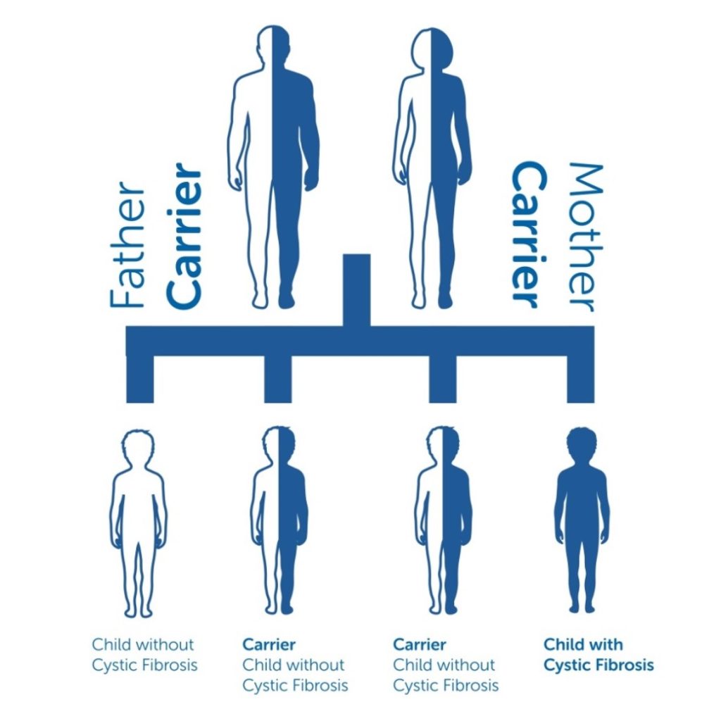 Graphic showing the passing on of genes from biological parents who are carriers of a faulty Cystic Fibrosis gene to children, and the one in four possibility of their child inheriting both copies of the faulty gene and therefore being born with Cystic Fibrosis.